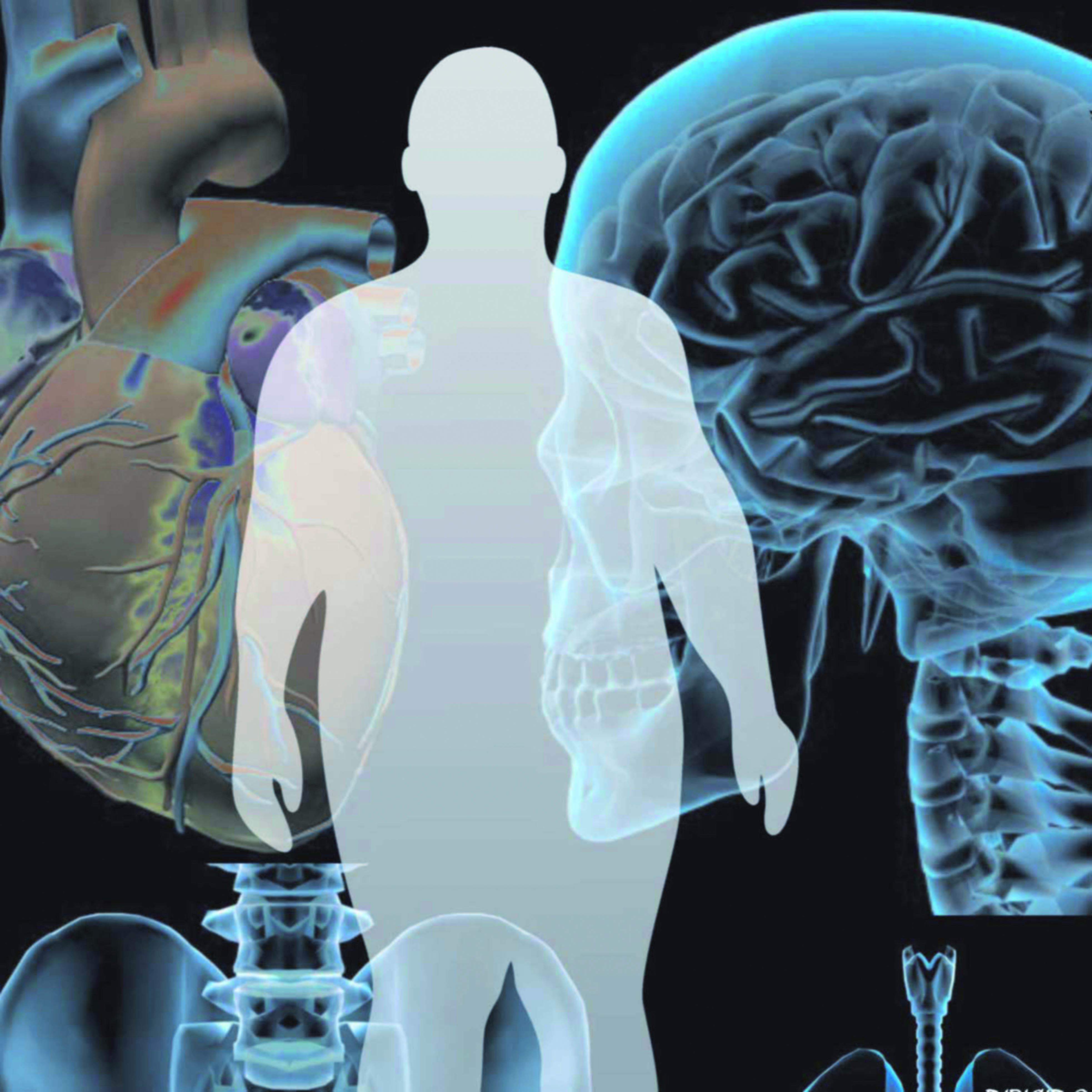 El síndrome metabólico: ¿Una enfermedad del cerebro?