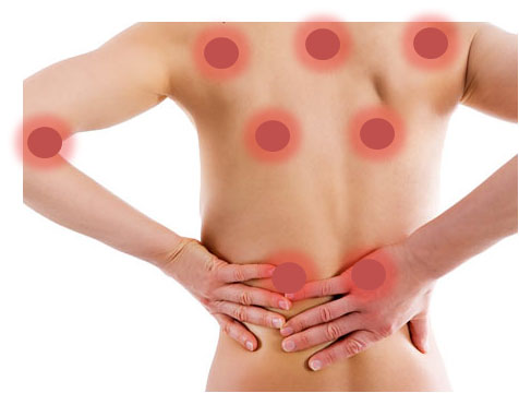 La misteriosa Fibromialgia: el padecimiento y el dolor silencioso