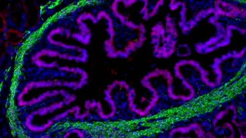 Se fabrican intestinos humanos trasplantados en ratones