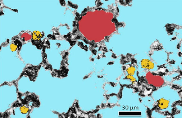 Así pasan los contaminantes desde el pulmón a la sangre