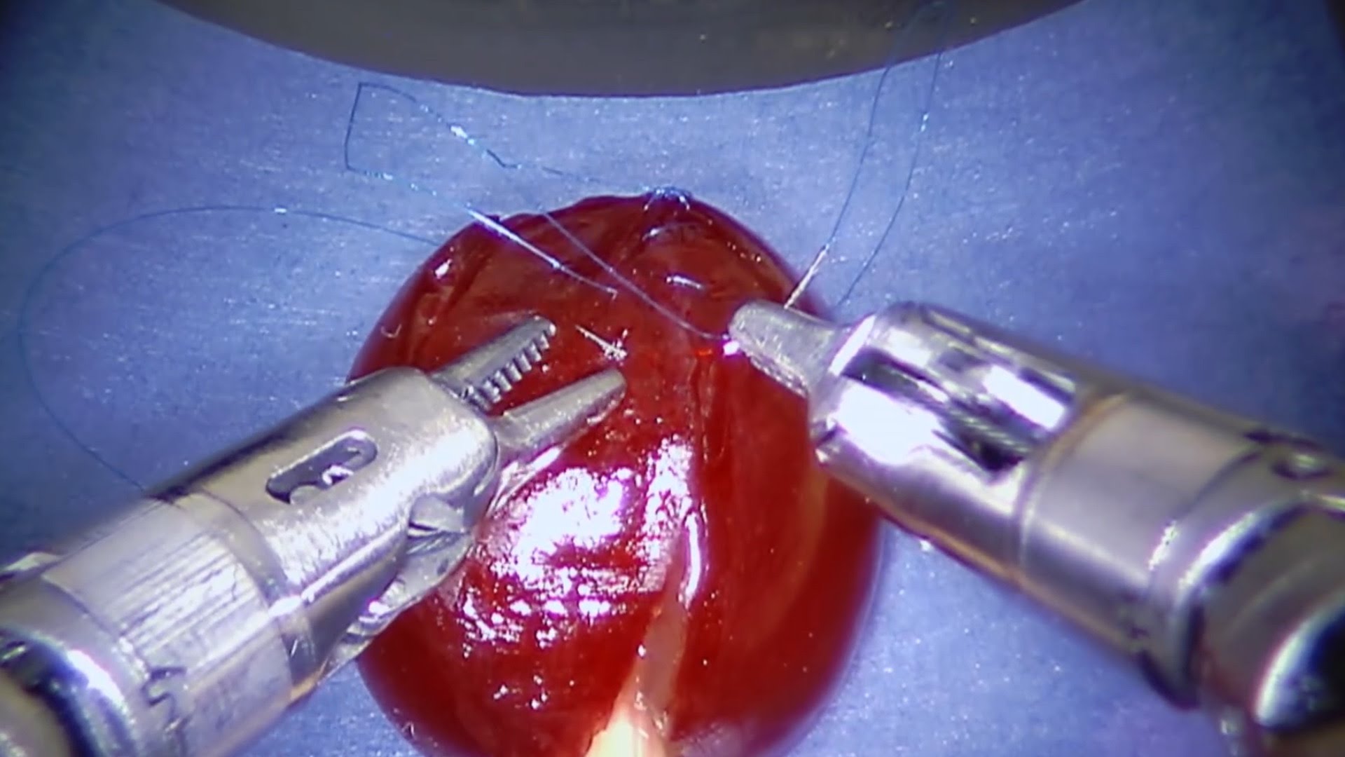 This surgical system can stitch a grape back together