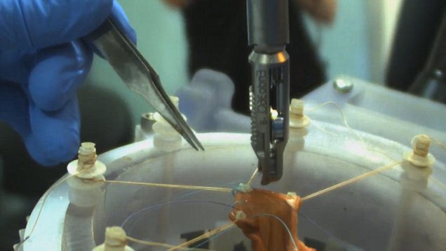 Robotic surgeon more precise than humans