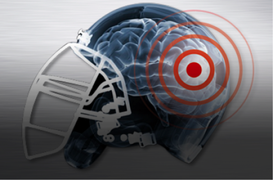 Tacleadas directas al encéfalo