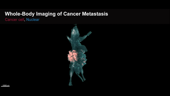 Así se expande una metástasis de cáncer en un ratón