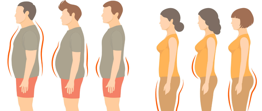 Exceso de grasa visceral desarrolla enfermedades cardiovasculares y diabetes del tipo 2