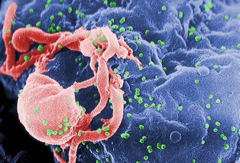 Cada vez más cerca de a una cura para el SIDA