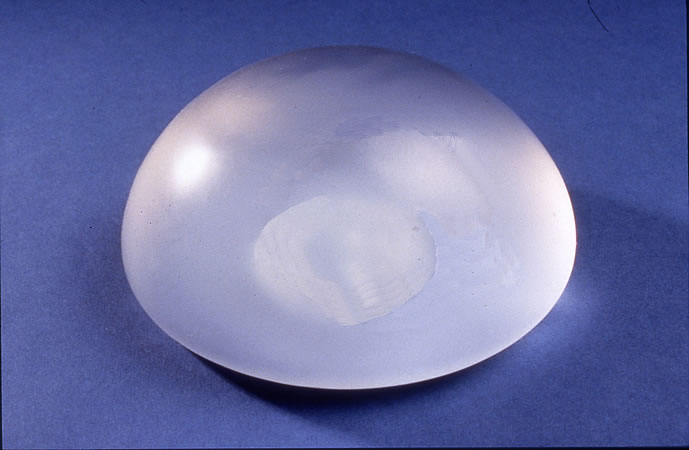 Las prótesis de mama necesitan reemplazo regular