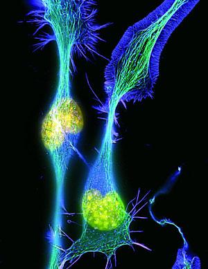 Algo sobre Biología de Sistemas