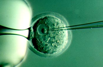 Terapia génica: Aplazamiento de una satisfacción humana y científica