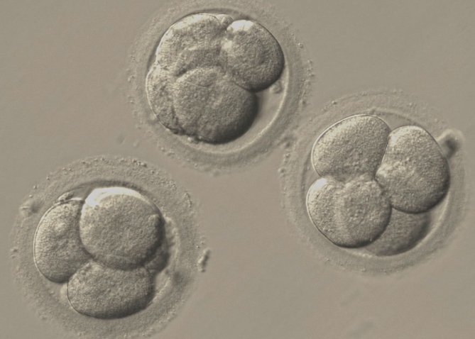 La Eugenesia, la polémica científica de nuestro siglo