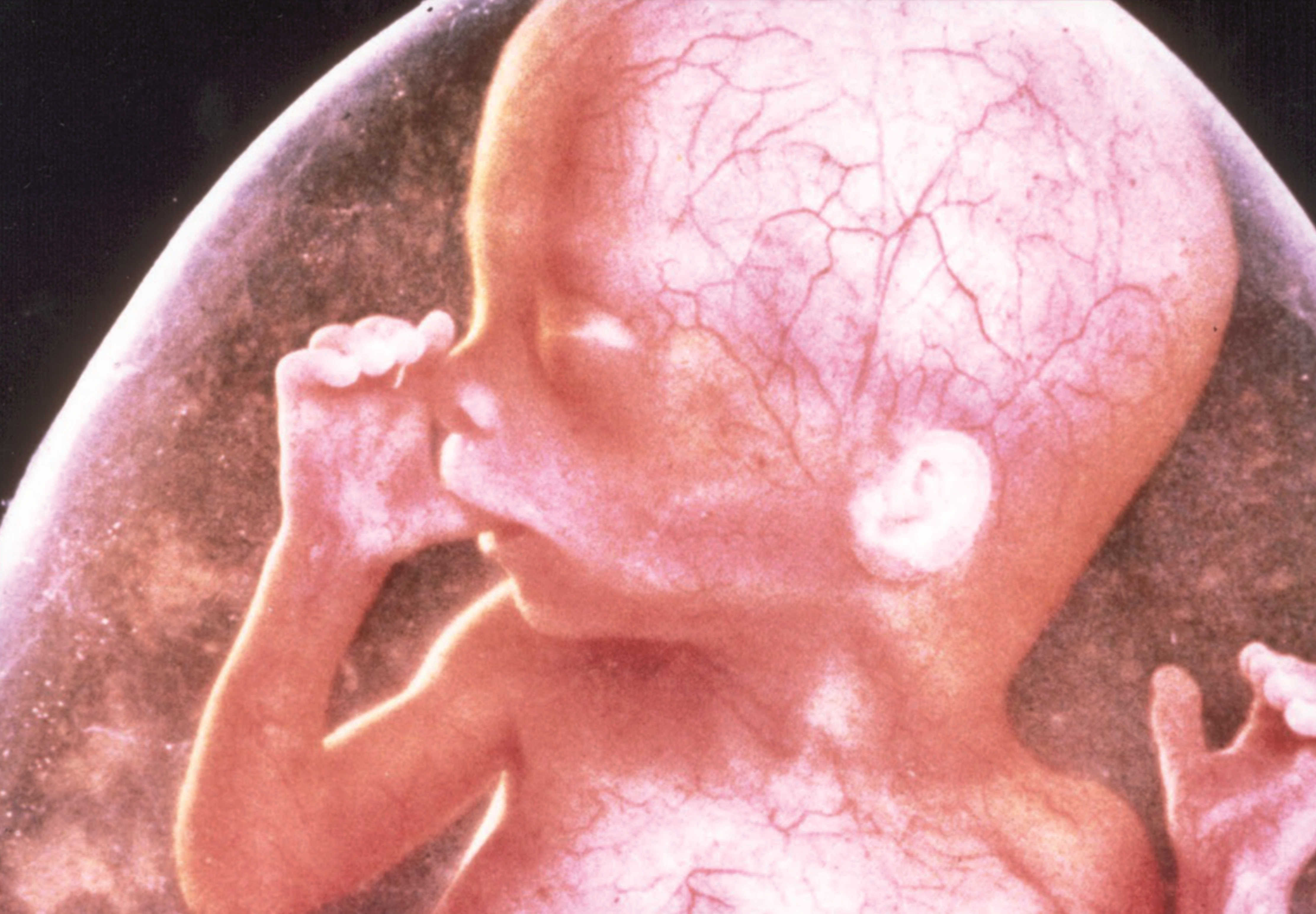 Técnicas de reproducción asistida en la UANL