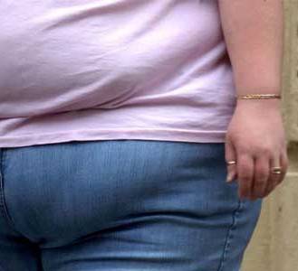Stroke Rounds: Study Questions ‘Obesity Paradox’