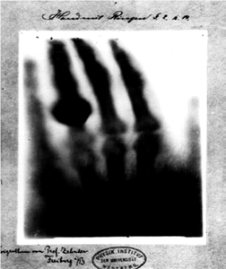 El papel de la Radioterapia en el tratamiento del cáncer