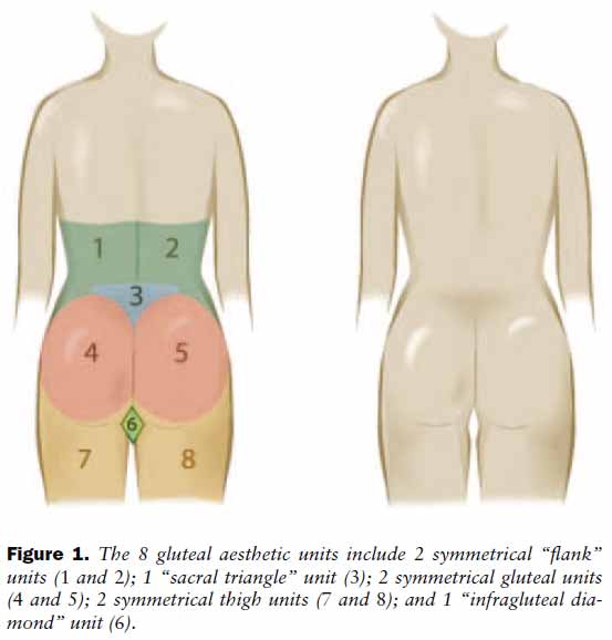 Gluteal Aesthetic Unit Classification