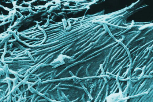 Understanding Ebola: Outbreak In Guinea