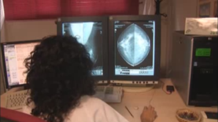 El cáncer de mama, camino de convertirse en enfermedad crónica gracias a los nuevos tratamientos