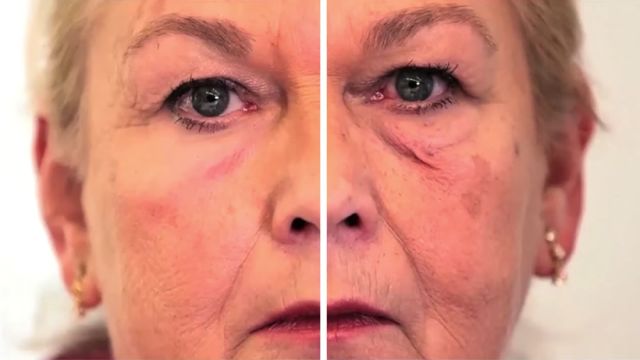 A second youthful skin using an elastic, wearable crosslinked polymer layer (XPL)