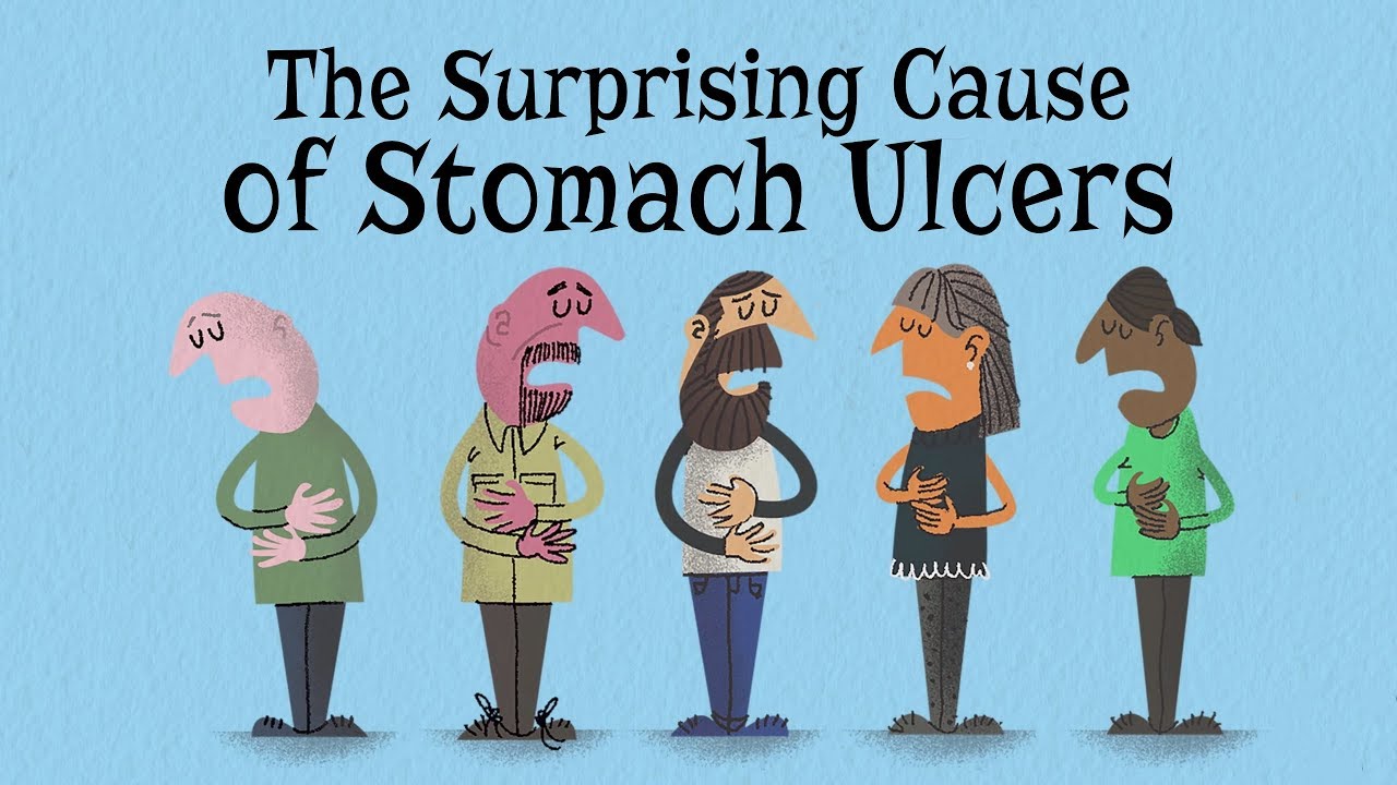 The surprising cause of stomach ulcers – Rusha Modi