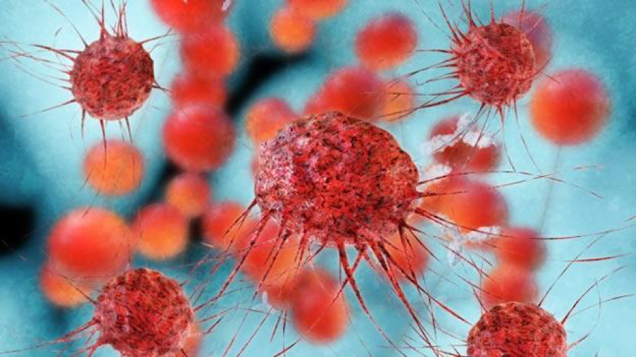 Las desigualdades económicas reflejan la incidencia de cáncer en el mundo