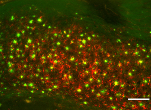 Nanopartículas para detectar alzhéimer con resonancia magnética
