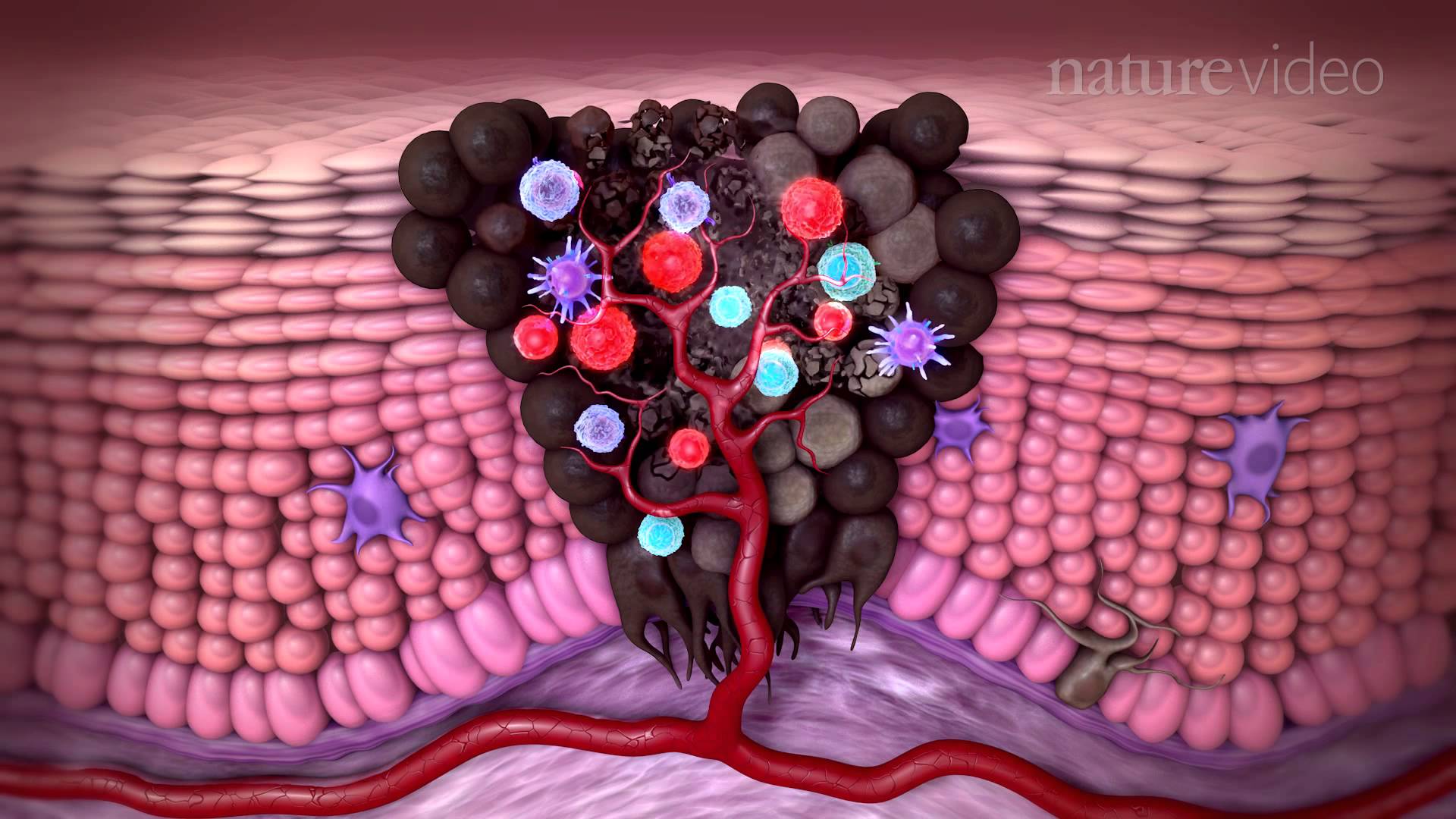 Tumour immunology and immunotherapy