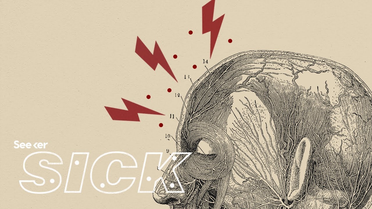 What Really Causes a Migraine?