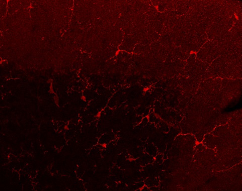 Descrito un efecto proinflamatorio de los endocannabinoides en el cerebro