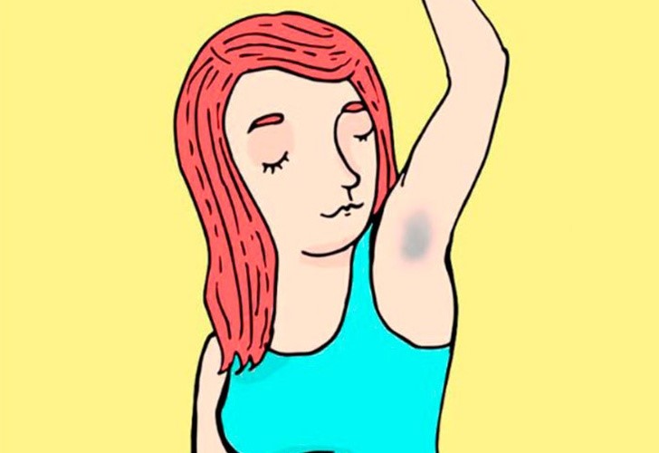 Acantosis: zonas oscuras que revelan daños en la salud