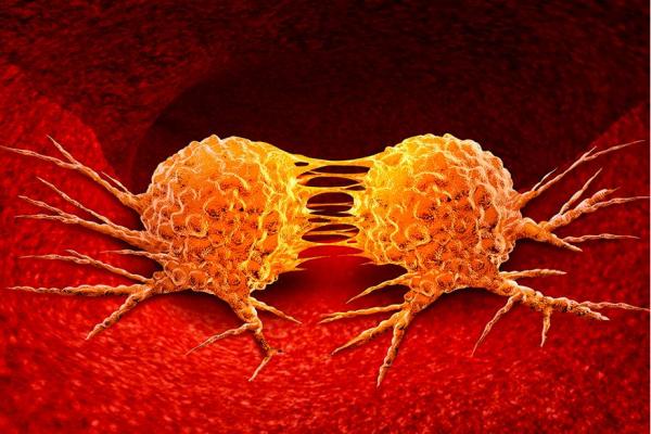 La parte mortal de la metastasis