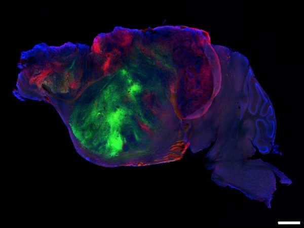 Cultivan tejido cerebral humano en modelos de ratón para el estudio de enfermedades